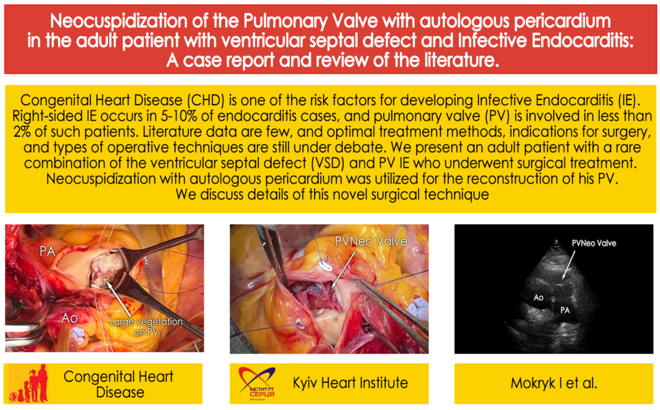 Neocuspidization of the Pulmonary Valve with Autologous Pericardium in the Adult Patient with Ventricular Septal Defect and Infective Endocarditis: A Case Report and Review of the Literature